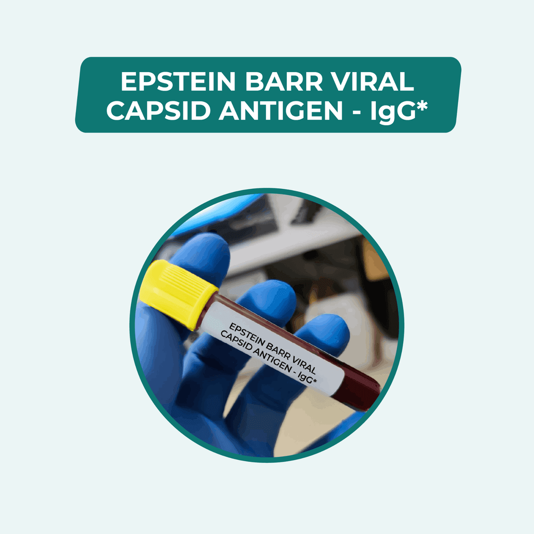EPSTEIN BARR VIRAL CAPSID ANTIGEN - IgG