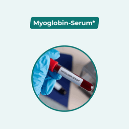 Myoglobin-Serum