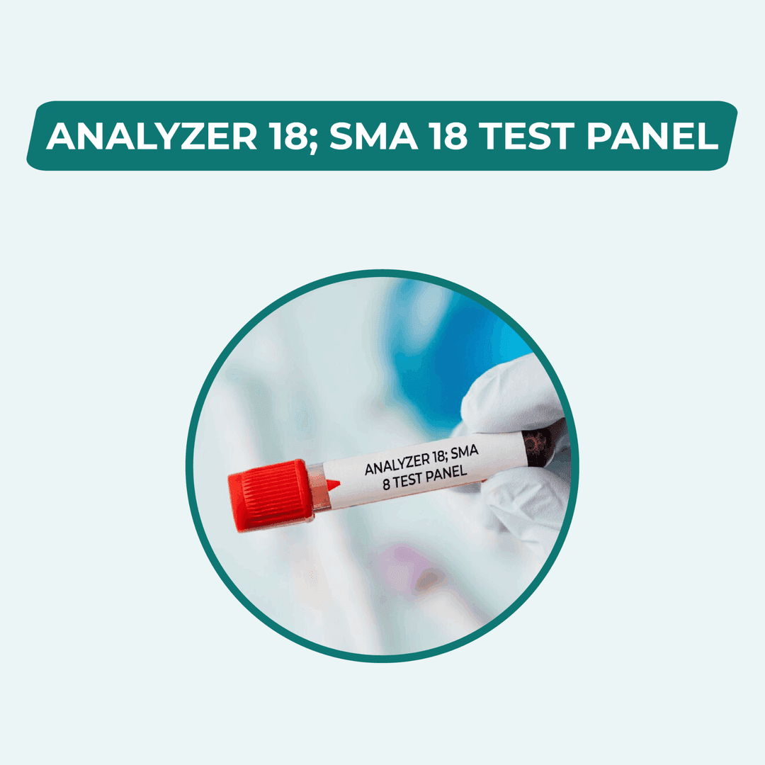 ANALYZER 18; SMA 18 TEST PANEL