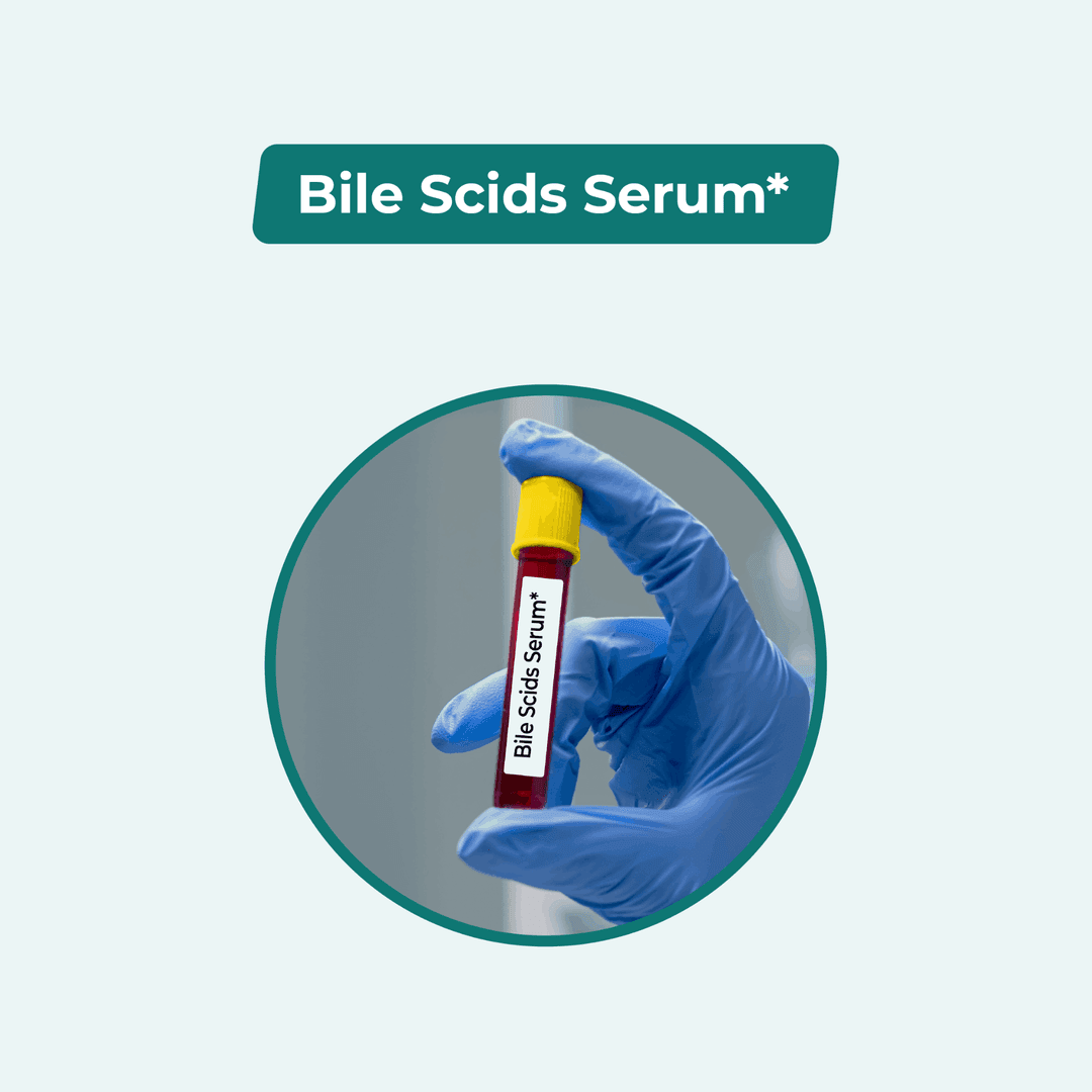 Serum Bile Acid