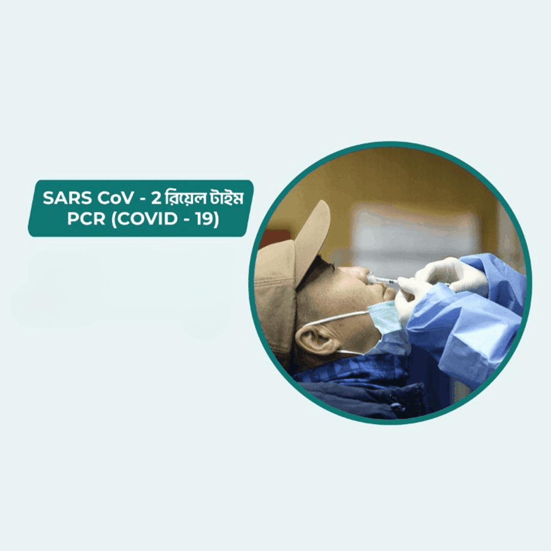SARS CoV -2 REAL TIME PCR (COVID-19)