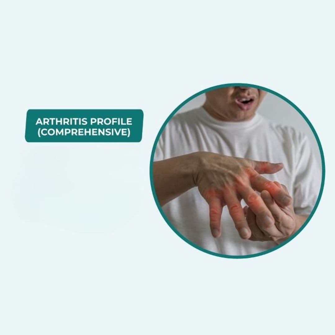Arthritis Profile (COMPREHENSIVE)