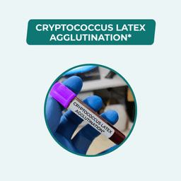 CRYPTOCOCCUS LATEX AGGLUTINATION