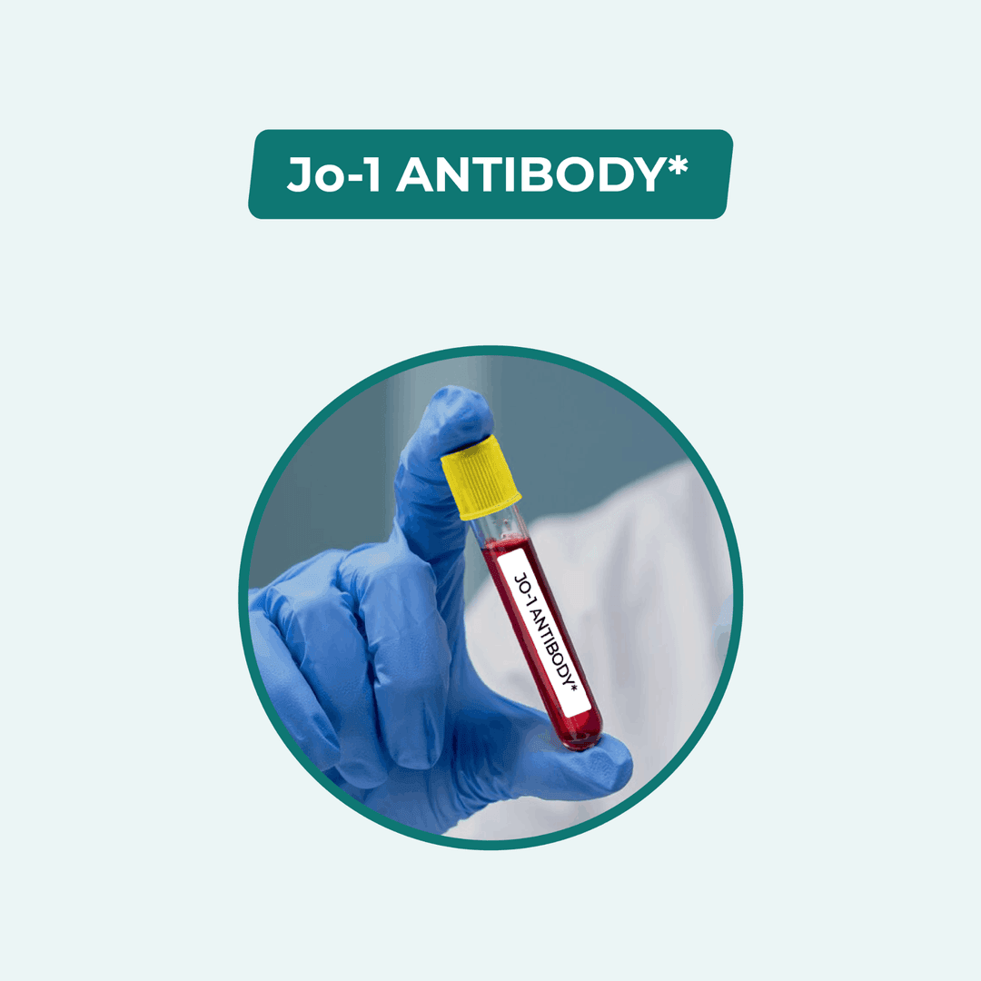 Jo-1 ANTIBODY