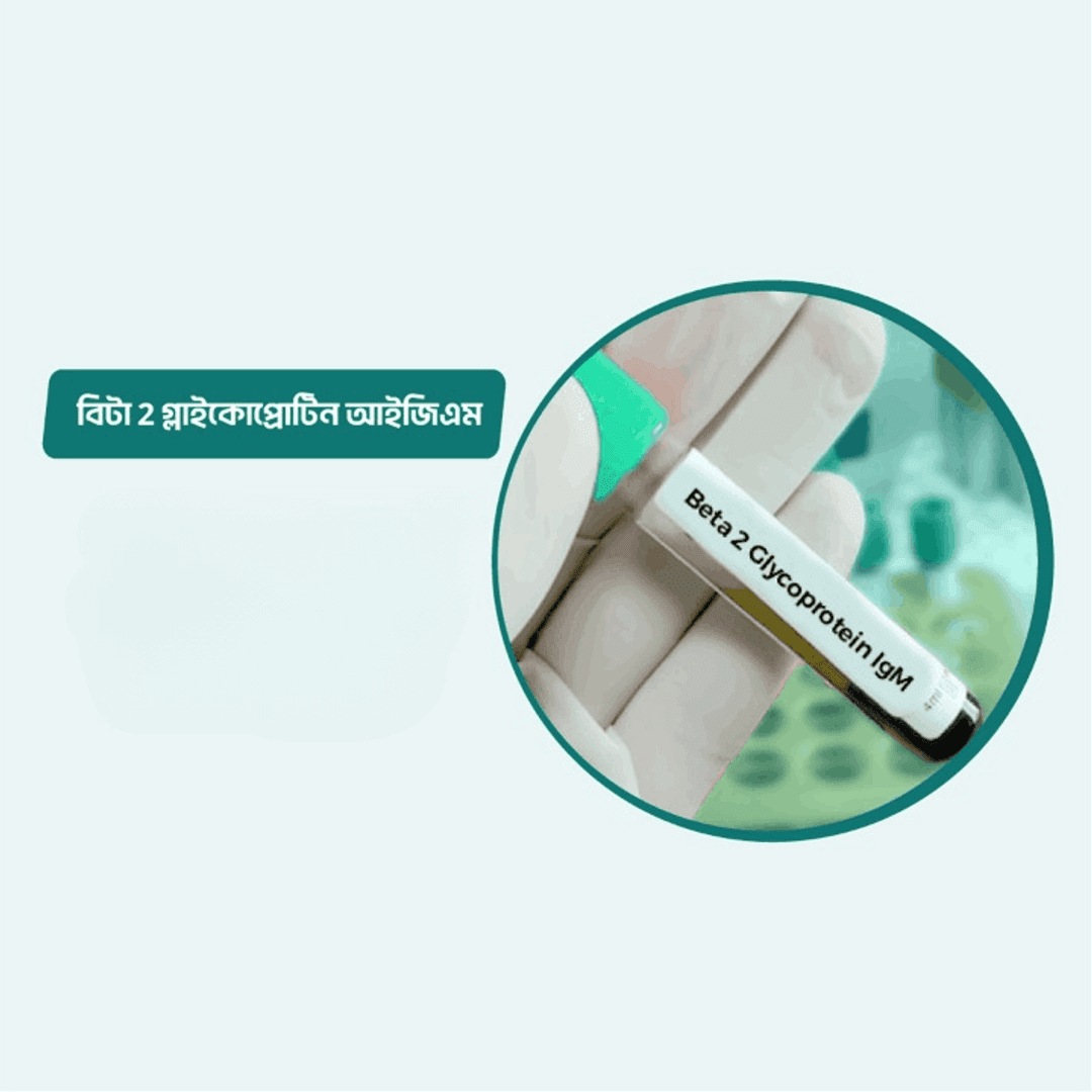 Beta 2 Glycoprotein IgM/Anti-B-2 Glycoprotein IgM