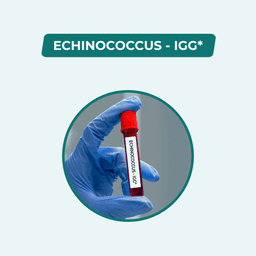ECHINOCOCCUS IgG