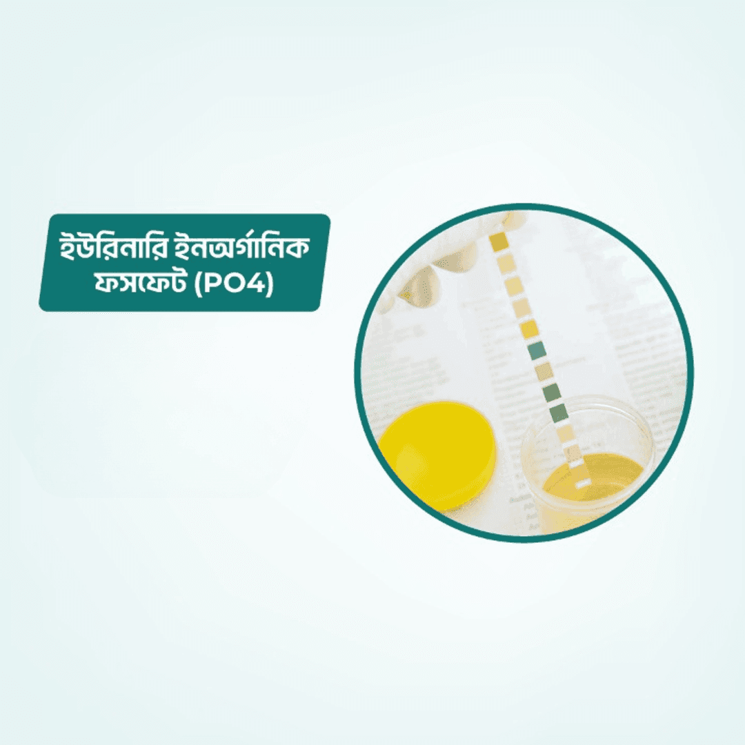 Urinary Inorganic Phosphate (PO4)
