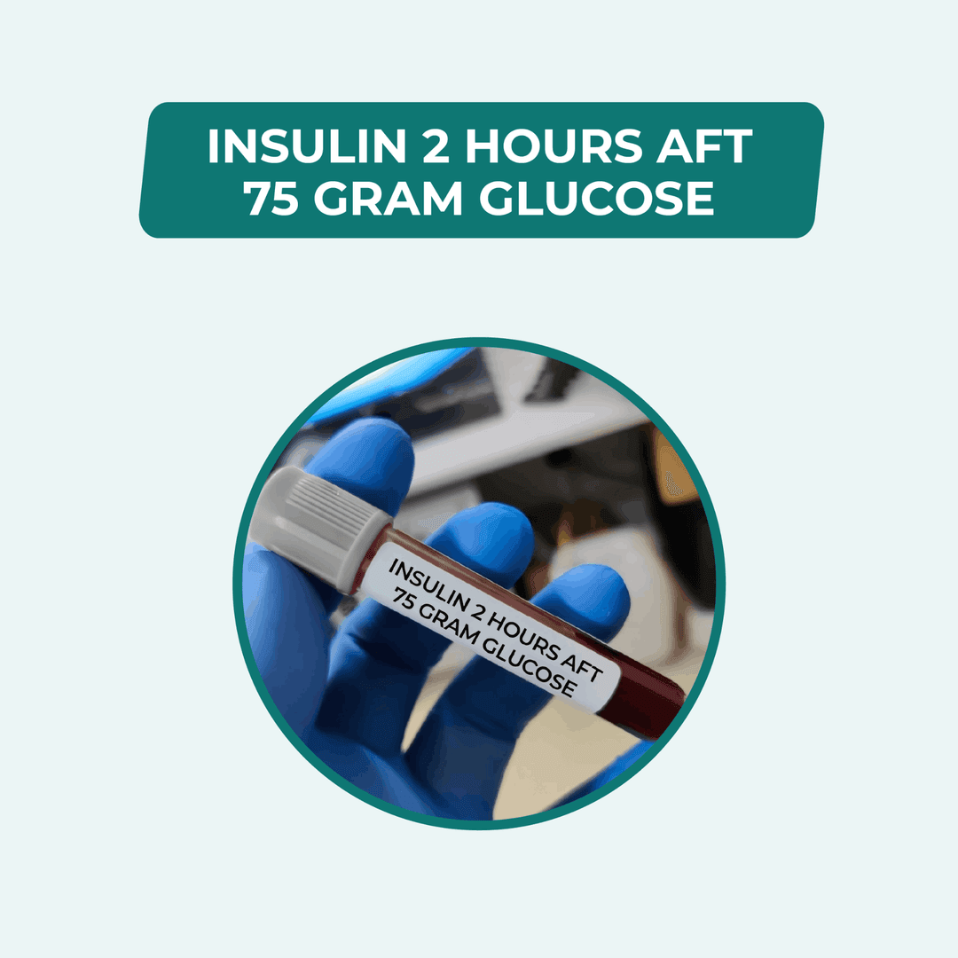 INSULIN 2 HOURS AFT 75 GRAM GLUCOSE